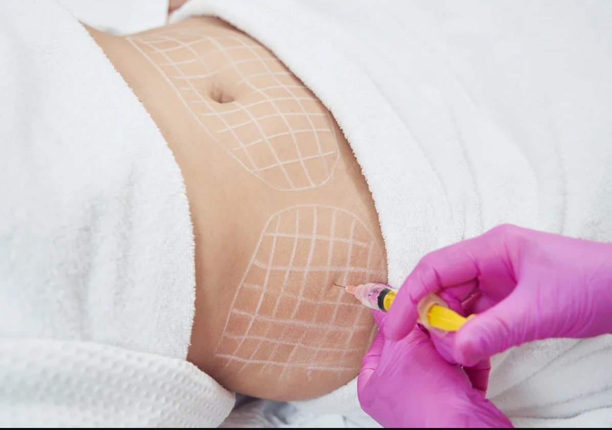 Woman receiving Fat Dissolving Injections treatment